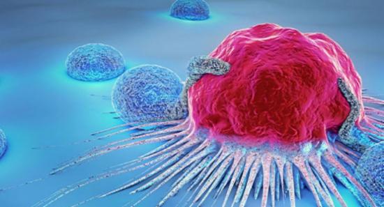 SL Sees 100 New Cancer Cases, 40 Deaths Daily